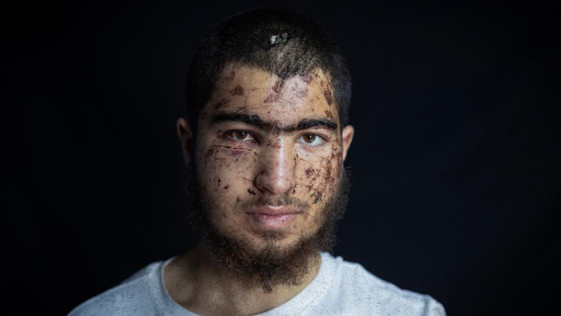 אנטומיה של חטיפה - מתנחלים חטפו נער פלסטיני והתעללו בו במשך שעות. מקרה אחד שמצביע על מגמה מפחידה