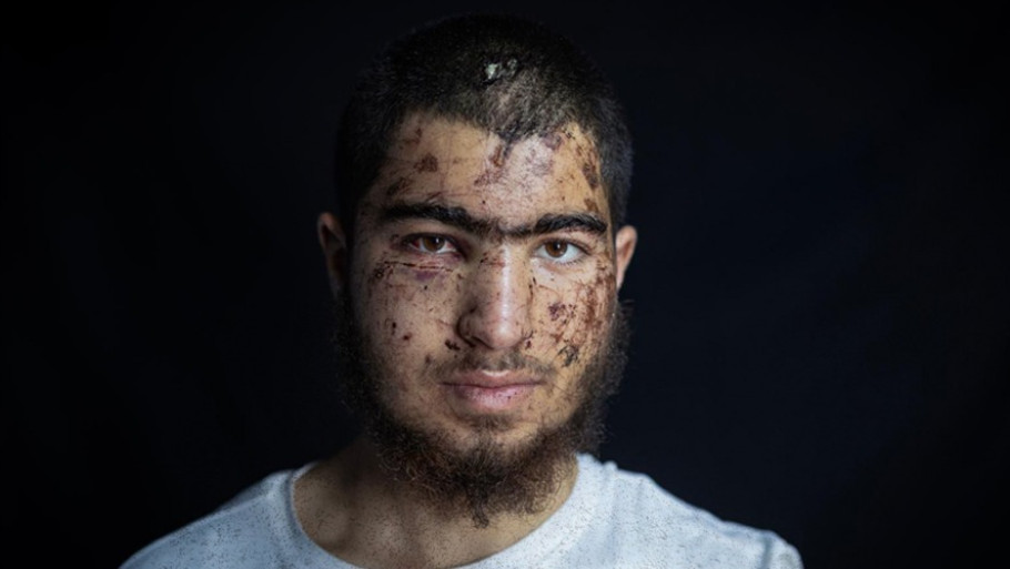 אנטומיה של חטיפה - מתנחלים חטפו נער פלסטיני והתעללו בו במשך שעות. מקרה אחד שמצביע על מגמה מפחידה